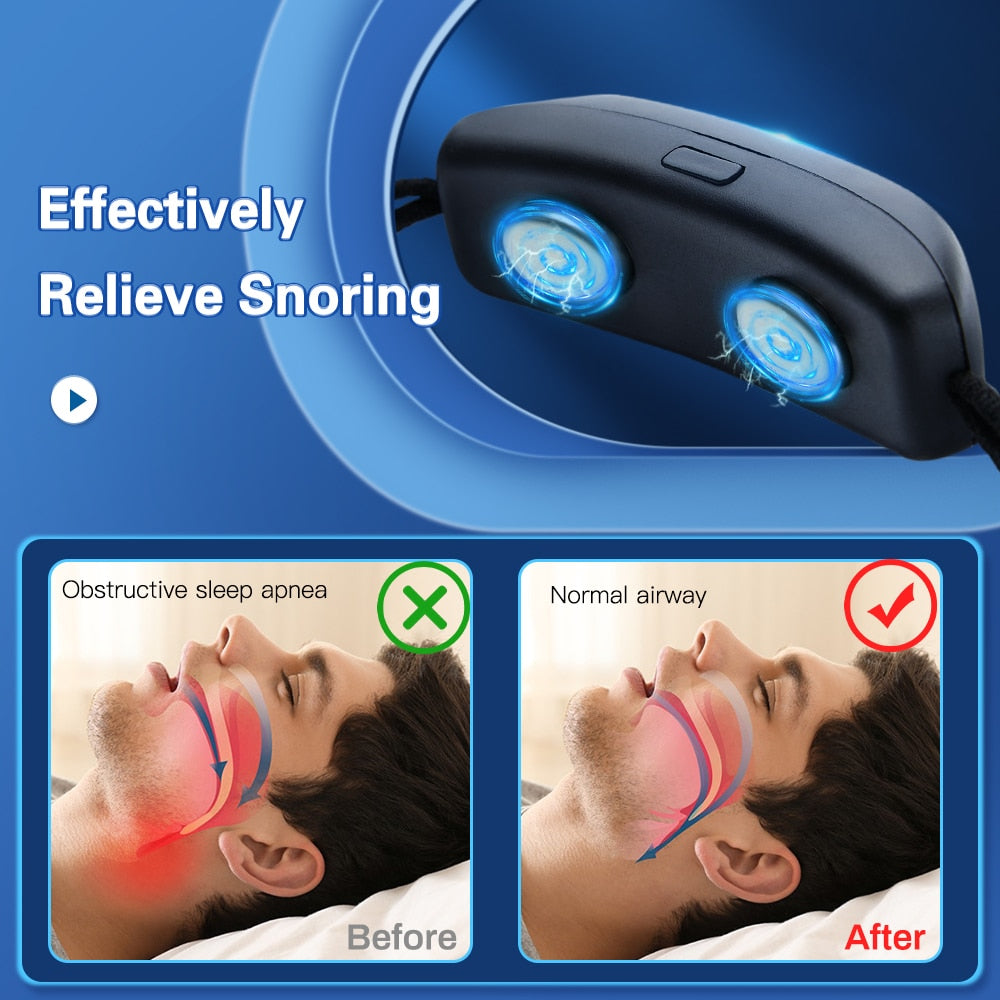 Sleep Saver Smart Anti-Snoring Device